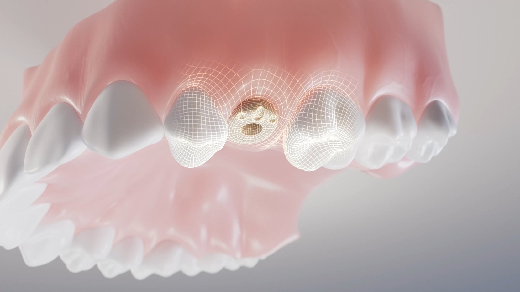 CAMLOG – Jaw cross-section visualization